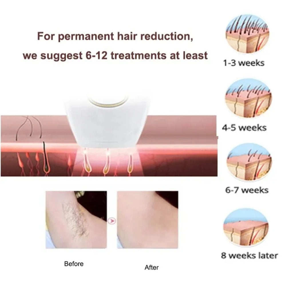 IPL Laser Hair Removal Handset – At-Home Hair Removal System for Women & Men with Razor & Safety Glasses